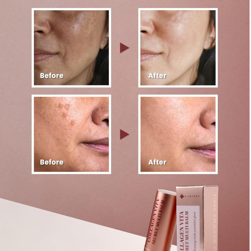 KSECRET Collagen Vita Secret Multi Balm 11g